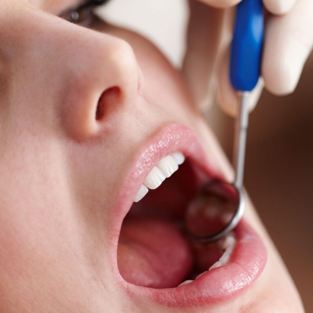 salud intestinal afecta a tu salud bucal
